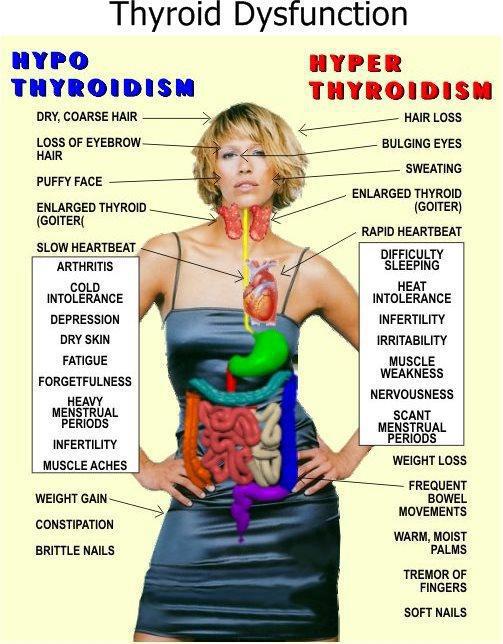 thyroid-problems